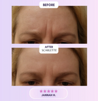 Scarlette - Silicone Scar & Wrinkle Collegen Sheets