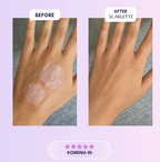 Scarlette - Silicone Scar & Wrinkle Collegen Sheets