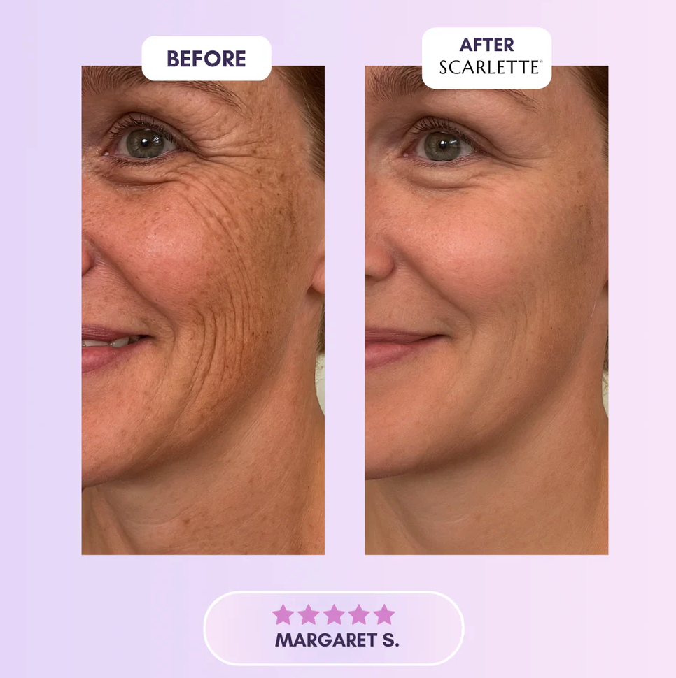 Scarlette - Silicone Scar & Wrinkle Collegen Sheets