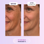 Scarlette - Silicone Scar & Wrinkle Collegen Sheets