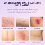 Scarlette - Silicone Scar & Wrinkle Collegen Sheets