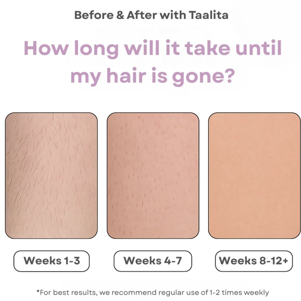 IPL - Portable Laser Hair Remover