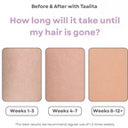 IPL - Portable Laser Hair Remover