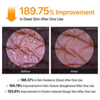 Peel Shot Keratin Care Kojic Acid Turmeric Spray